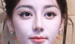 明星毛孔粗大,揭秘毛孔粗大成因与应对策略