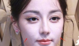 明星毛孔粗大,揭秘毛孔粗大成因与应对策略